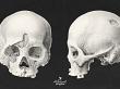 CU Vintage Anatomy No 1 Skulls by A Whimsical Adventure at Oscraps